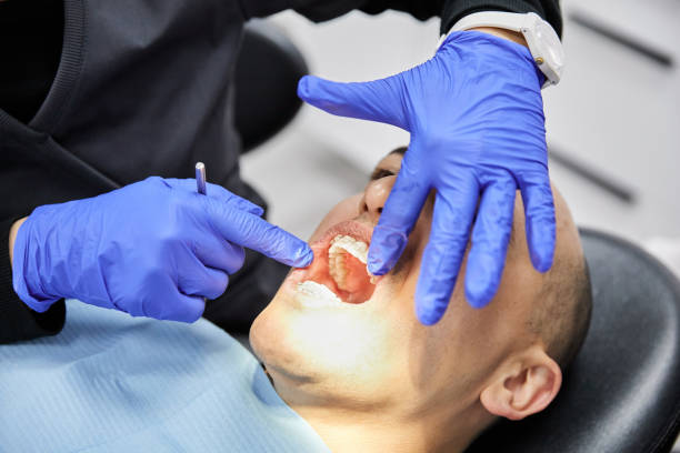 Best Emergency Wisdom Teeth Removal in Lake Lure, NC