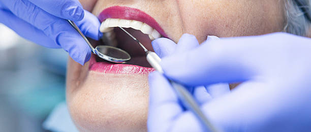 Best Emergency Root Canal Treatment in Lake Lure, NC